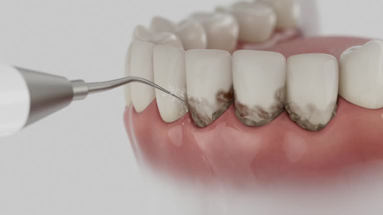 Reliable Dental contractor in Punta Rassa, FL by Dentist Open Now